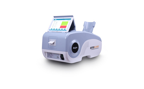 國產(chǎn)骨密度分析儀