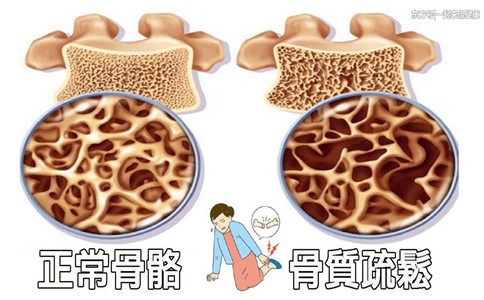 骨密度測(cè)定儀廠(chǎng)家