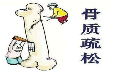 骨密度測(cè)試儀品牌